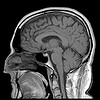 brain image